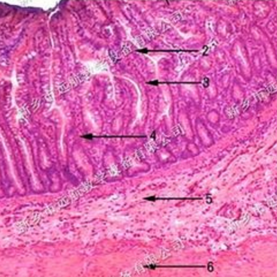 回肠教学切片